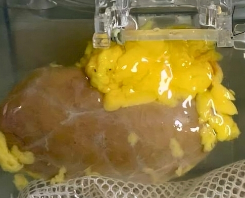 Scientists Created a ‘Universal’ Kidney To Match Any Blood Type : ScienceAlert Scientists Created a ‘Universal’ Kidney To Match Any Blood Type : ScienceAlert