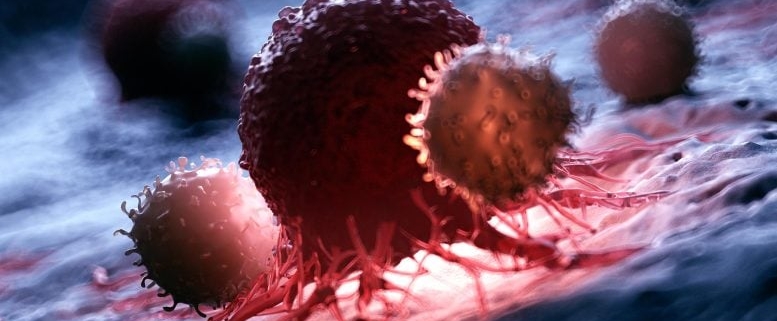 Scientists Found Cancer’s Invisibility Switch