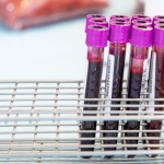 A Simple Blood Test Could Eventually Tell You When Alzheimer’s Is Coming A Simple Blood Test Could Eventually Tell You When Alzheimer’s Is Coming