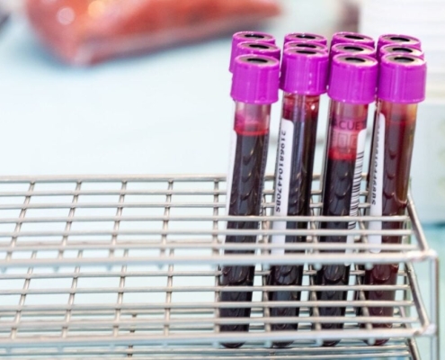 A Simple Blood Test Could Eventually Tell You When Alzheimer’s Is Coming