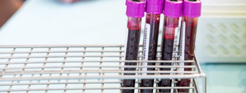 A Simple Blood Test Could Eventually Tell You When Alzheimer’s Is Coming
