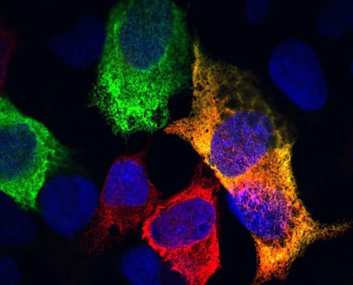 Scientists May Have Found The Key Cellular Process Behind Aging in Animals : ScienceAlert