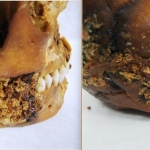 Iron Age Surgeons Fixed a Woman’s Shattered Jaw With Primitive Prosthetic—and She Survived