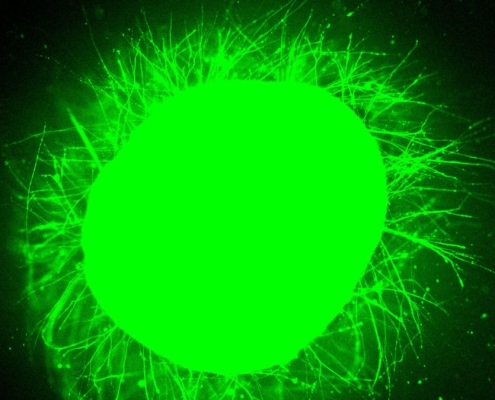 Scientists Grew Mini Human Spinal Cords, Then Made Them Repair After Injury : ScienceAlert