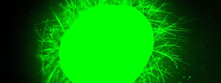 Scientists Grew Mini Human Spinal Cords, Then Made Them Repair After Injury : ScienceAlert