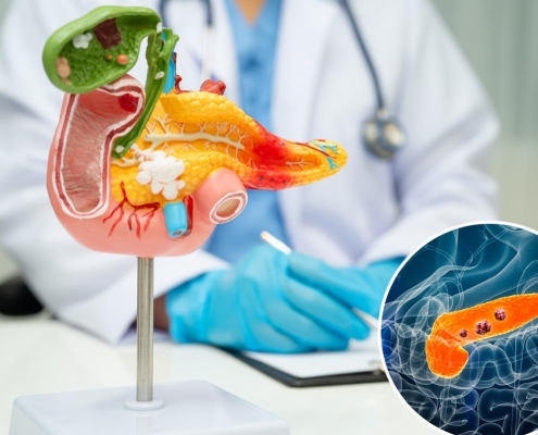 Pancreatic cancer breakthrough: tumors disappear in mice