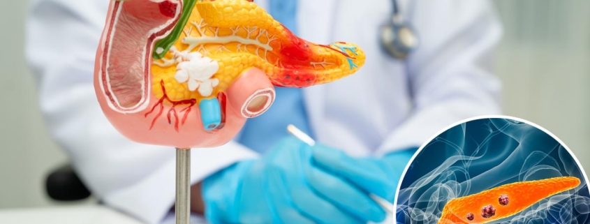 Pancreatic cancer breakthrough: tumors disappear in mice