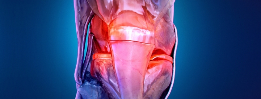 Osteoarthritis Is Appearing in Younger Adults, Triggering Decades of Discomfort : ScienceAlert Osteoarthritis Is Appearing in Younger Adults, Triggering Decades of Discomfort : ScienceAlert