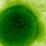 This Extreme Radiation-Resistant Organism Evolved a Remarkable Ability : ScienceAlert