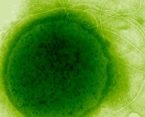 This Extreme Radiation-Resistant Organism Evolved a Remarkable Ability : ScienceAlert