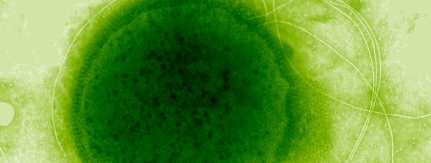 This Extreme Radiation-Resistant Organism Evolved a Remarkable Ability : ScienceAlert This Extreme Radiation-Resistant Organism Evolved a Remarkable Ability : ScienceAlert