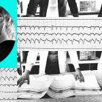 Technology Is Reshaping Sleep Apnea Treatment