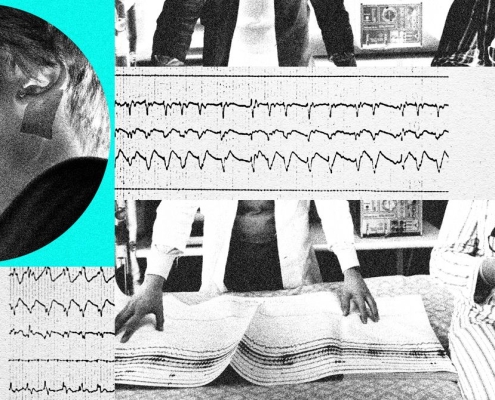 Technology Is Reshaping Sleep Apnea Treatment