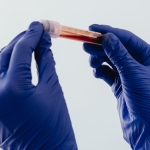 Women in Space Could Face a Hidden Blood-Clot Risk, Study Suggests : ScienceAlert