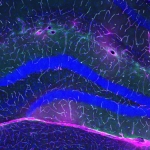 Exercise Protects Against Alzheimer’s, And Scientists May Finally Know Why : ScienceAlert