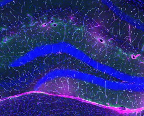 Exercise Protects Against Alzheimer’s, And Scientists May Finally Know Why : ScienceAlert