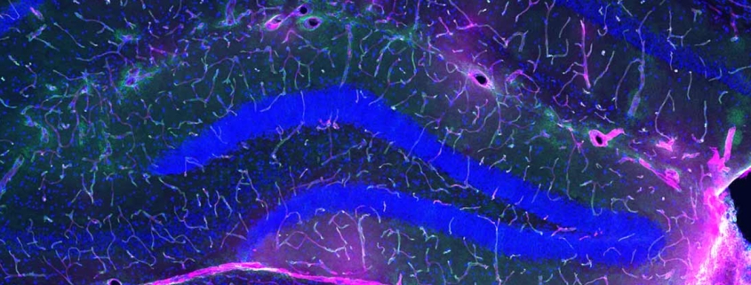 Exercise Protects Against Alzheimer’s, And Scientists May Finally Know Why : ScienceAlert