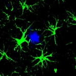 These Genetically Engineered Brain Cells Devour Toxic Alzheimer’s Plaques