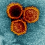 Scientists Discover New Evidence a Common Virus Helps Trigger MS : ScienceAlert