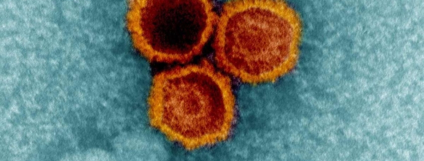 Scientists Discover New Evidence a Common Virus Helps Trigger MS : ScienceAlert