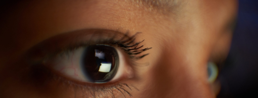 Why are vertebrate eyes so different from those of other animals?