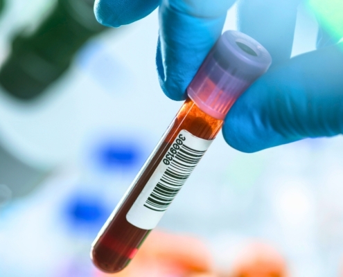 Blood Tests Could Revolutionize Early Cancer Detection – But There’s a Catch : ScienceAlert