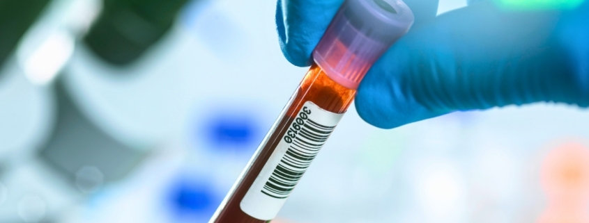 Blood Tests Could Revolutionize Early Cancer Detection – But There’s a Catch : ScienceAlert