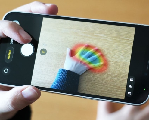 A Simple Photo of Your Hand Could Detect a Rare Health Disorder : ScienceAlert