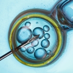 Major Study Finds IVF Not Linked to Cancer Risk, But There’s a Catch : ScienceAlert