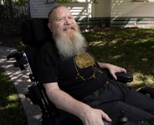 What It’s Like to Have a Brain Implant for 5 Years