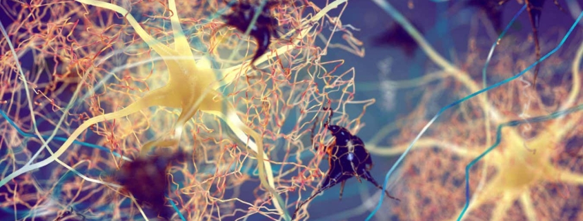 Alzheimer’s may start with inflammation in the skin, lungs or gut