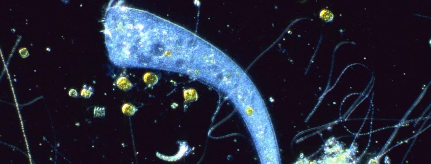 A unicellular organism with no brain is capable of Pavlovian learning