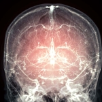 Major leap towards reanimation after death as mammal’s brain preserved Major leap towards reanimation after death as mammal’s brain preserved