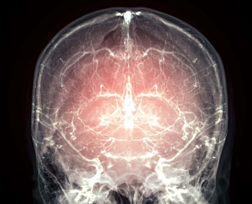 Major leap towards reanimation after death as mammal’s brain preserved