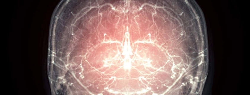 Major leap towards reanimation after death as mammal’s brain preserved