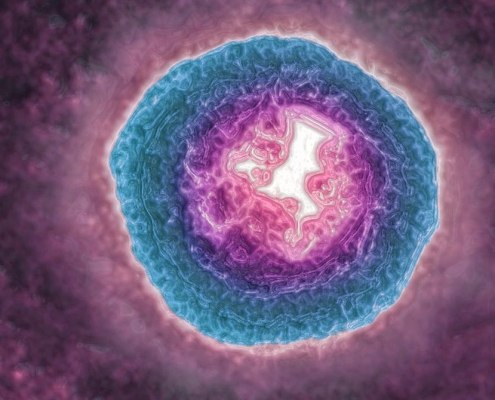 The Shingles Virus May Be Aging You More Quickly The Shingles Virus May Be Aging You More Quickly