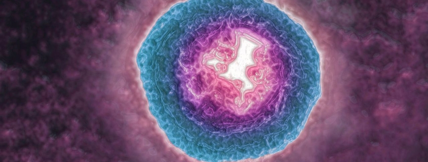 The Shingles Virus May Be Aging You More Quickly The Shingles Virus May Be Aging You More Quickly