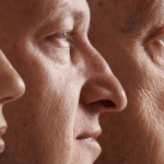 Study Reveals a 'Turning Point' in US Life Expectancy