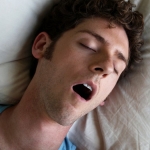 Repurposed Drug Improves Sleep Apnea by Up to 50% in Clinical Trial : ScienceAlert