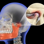 New Enzyme Discovery Could Protect Jaw Cartilage and Stop Arthritis