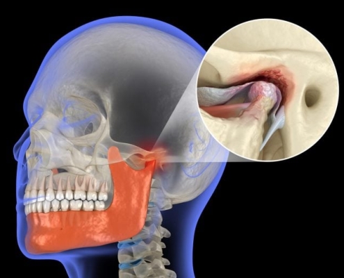 New Enzyme Discovery Could Protect Jaw Cartilage and Stop Arthritis