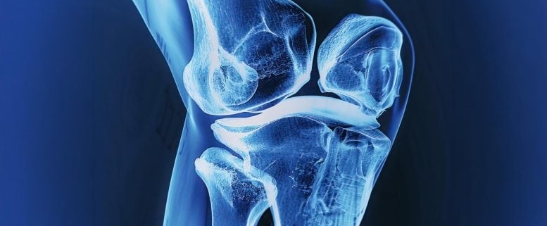 This Jelly-Like Implant Could Help Broken Bones Heal Themselves