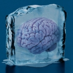 The Download: reawakening frozen brains, and the AI Hype Index returns