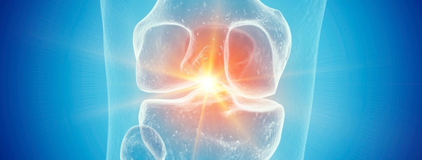 Semaglutide May Reverse Damage Caused by Osteoarthritis, Study Suggests : ScienceAlert