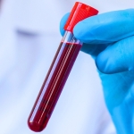 The Blood of Centenarians Reveals 37 Proteins Linked With Slower Aging : ScienceAlert