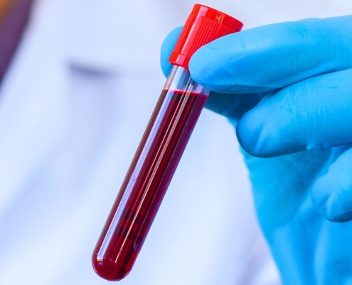 The Blood of Centenarians Reveals 37 Proteins Linked With Slower Aging : ScienceAlert