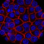 These Supercharged Immune Cells Completely Eliminated Solid Tumors in Mice