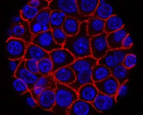 These Supercharged Immune Cells Completely Eliminated Solid Tumors in Mice These Supercharged Immune Cells Completely Eliminated Solid Tumors in Mice