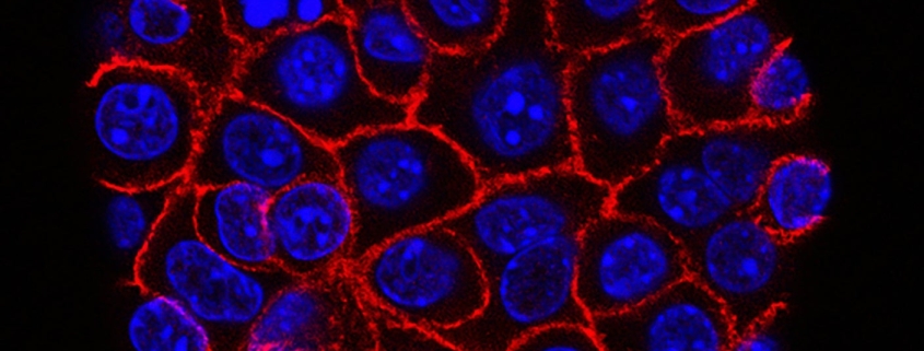 These Supercharged Immune Cells Completely Eliminated Solid Tumors in Mice
