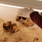 Rare Genetic Disease Discovered in Ancient Skeletal Embrace From The Ice Age : ScienceAlert Rare Genetic Disease Discovered in Ancient Skeletal Embrace From The Ice Age : ScienceAlert